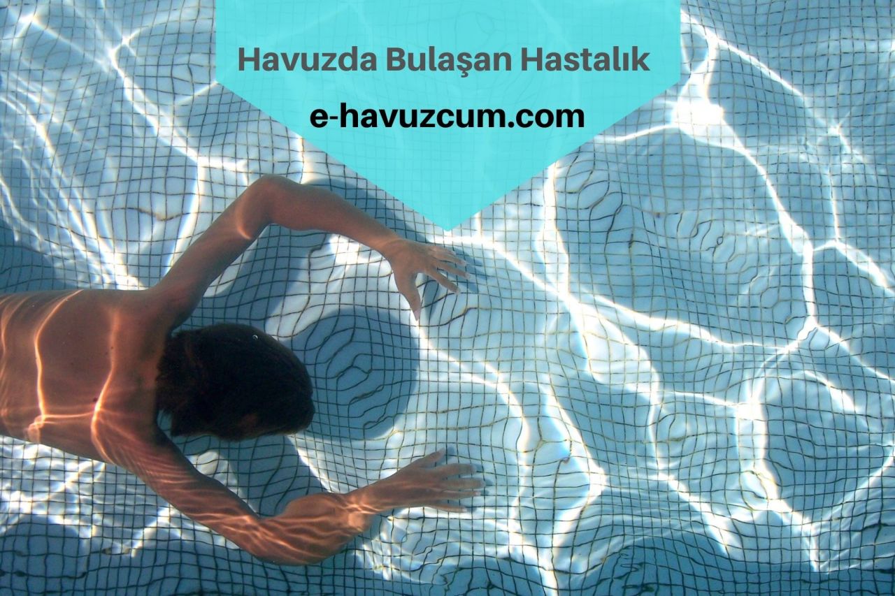 Havuzlarda Bulaşan Salgın Hastalıklar Nelerdir?